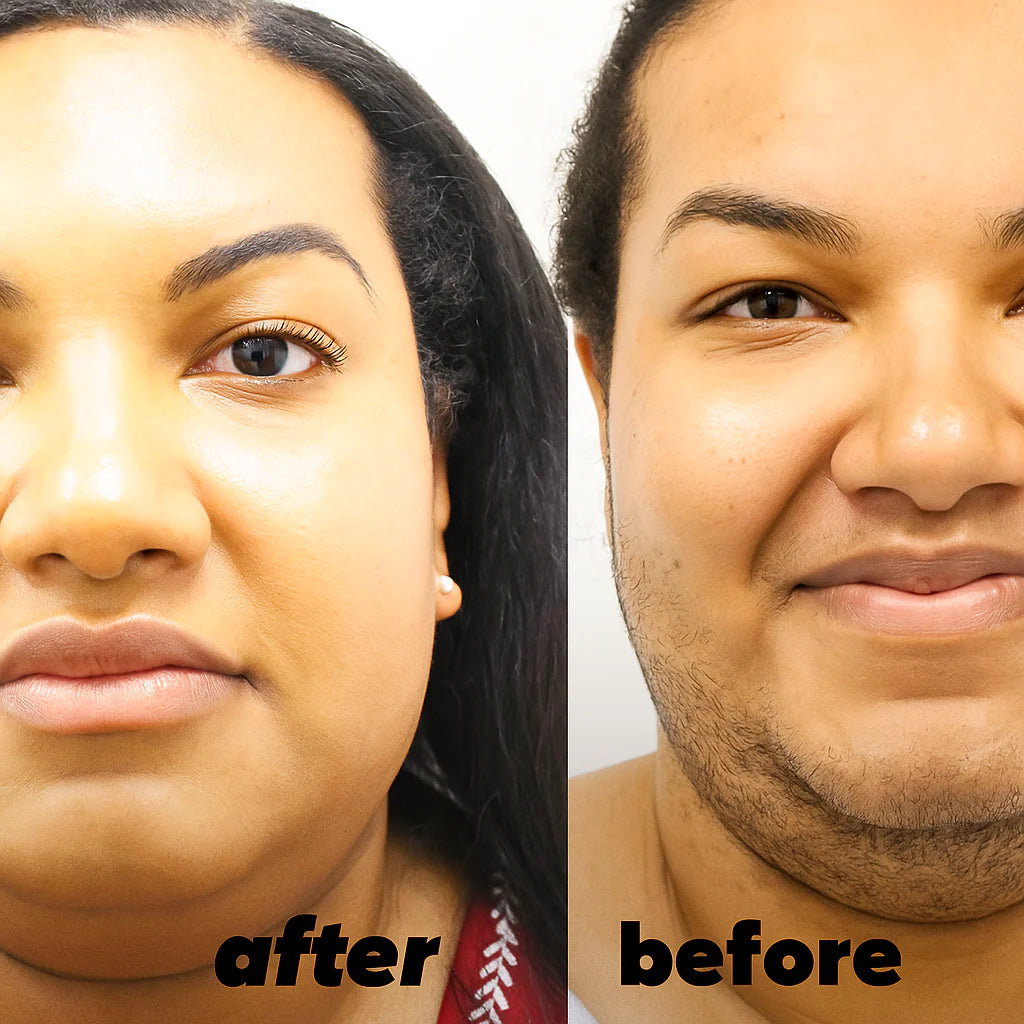 Cyperus Rotundus Skin Serum .