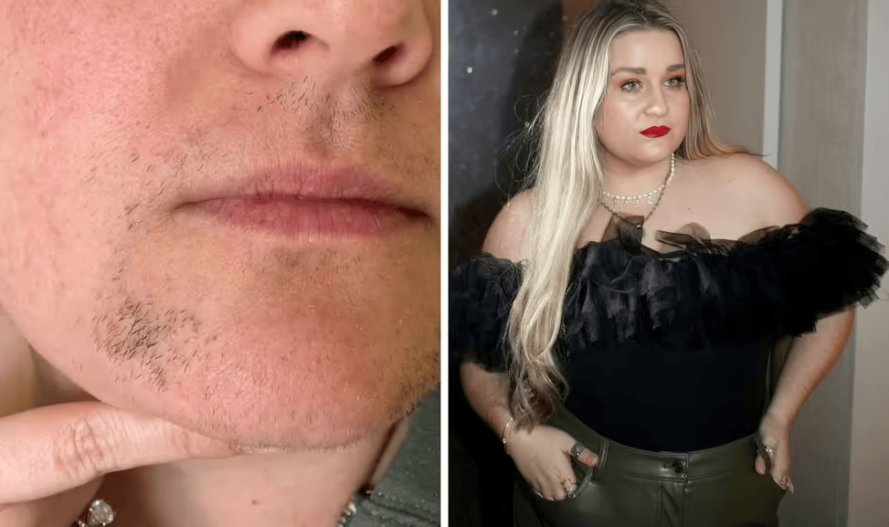 Cyperus Rotundus Skin Serum .