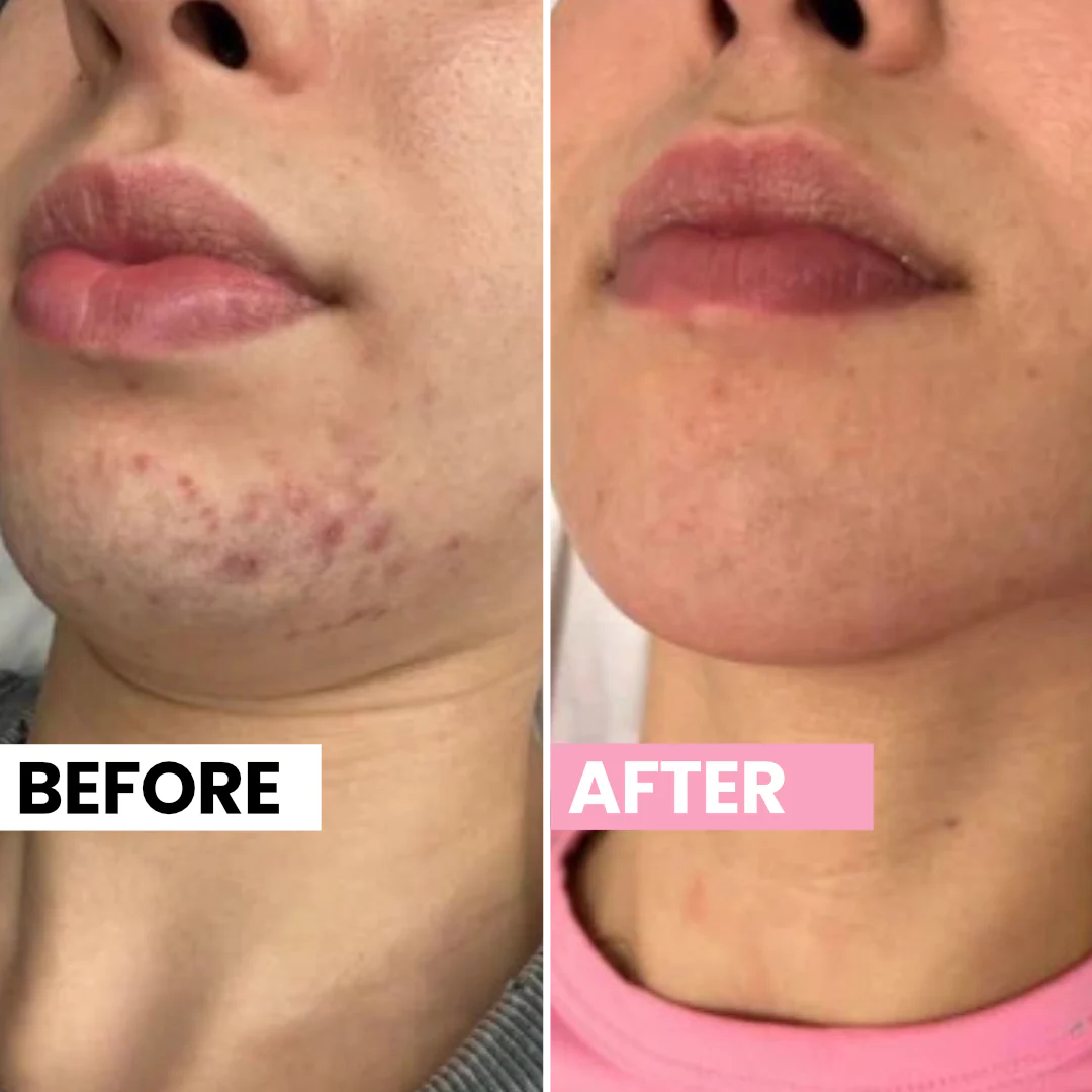 Cyperus Rotundus Skin Serum .