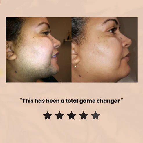 Lumiva™ Hair Removal Kit